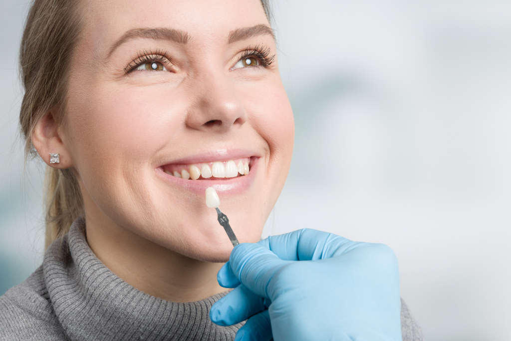 Women getting dental veneers - Medicred