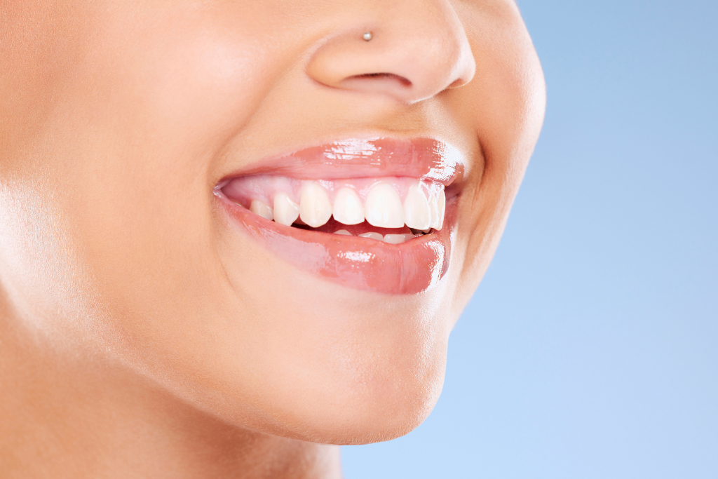 Financing for Veneers - Medicred